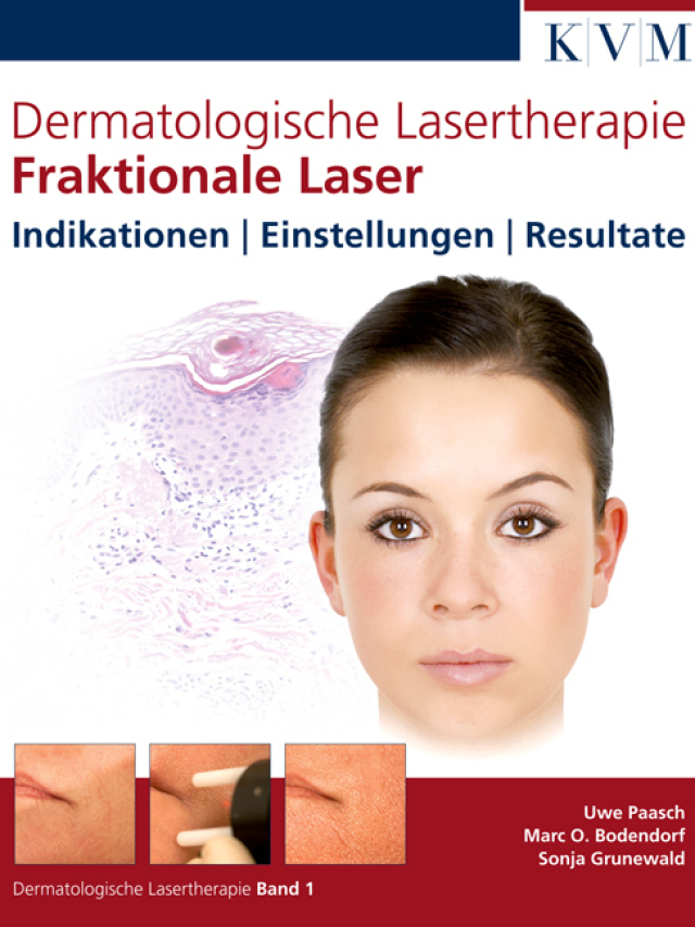 Dermatologische Lasertherapie Band 1. Fraktionale Laser