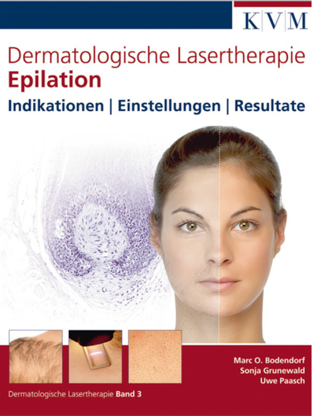 Dermatologische Lasertherapie Band 3. Epilation. Indikationen, Einstellungen, Resultate